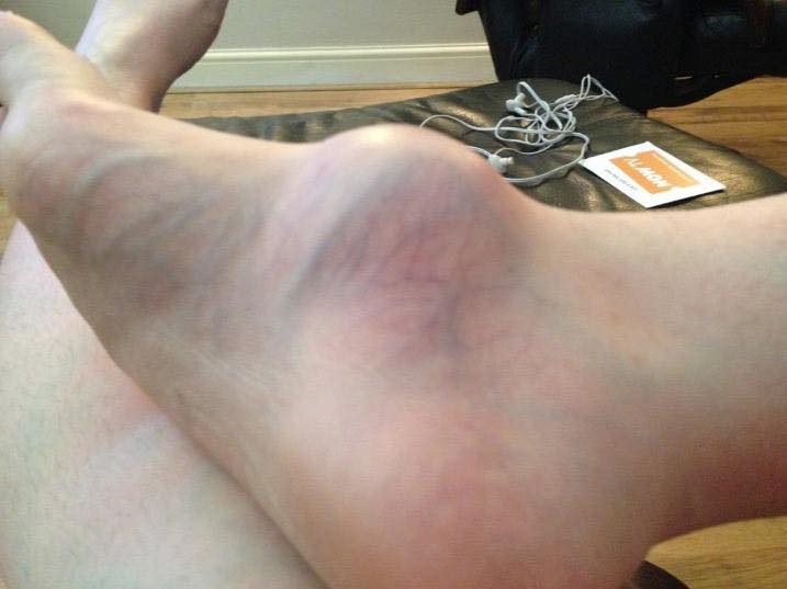 Her foot was swollen for years, finally she goes to the doctor, and he reveals the horrifying reason.