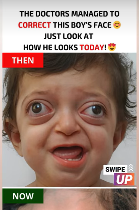 The doctors managed to correct this boy’s face. Just look at how he looks today! 