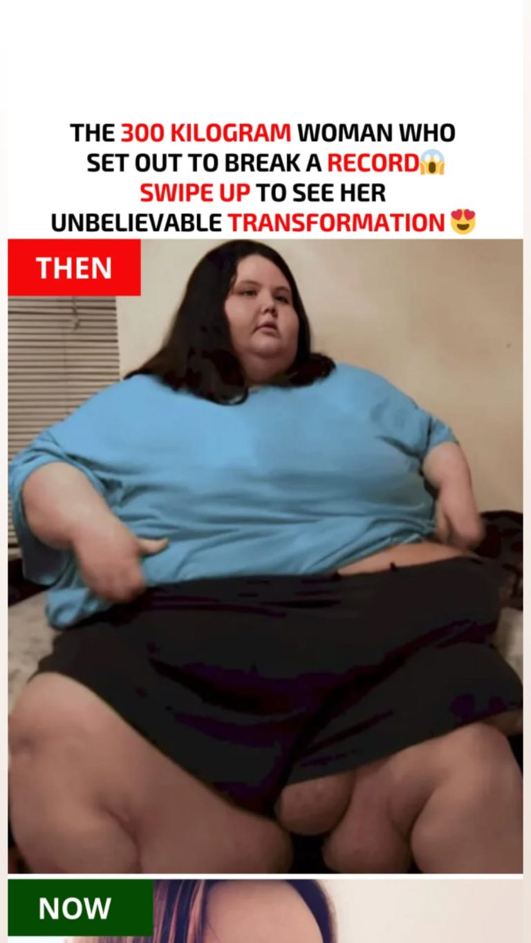 She weighed 300 kilograms and couldn’t walk – today she amazes everyone with her incredible transformation!
