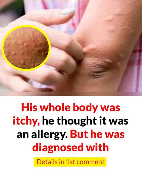 When an Itch Isn’t Just an Itch: James’s Story and the Silent Warning Signs of Skin Conditions