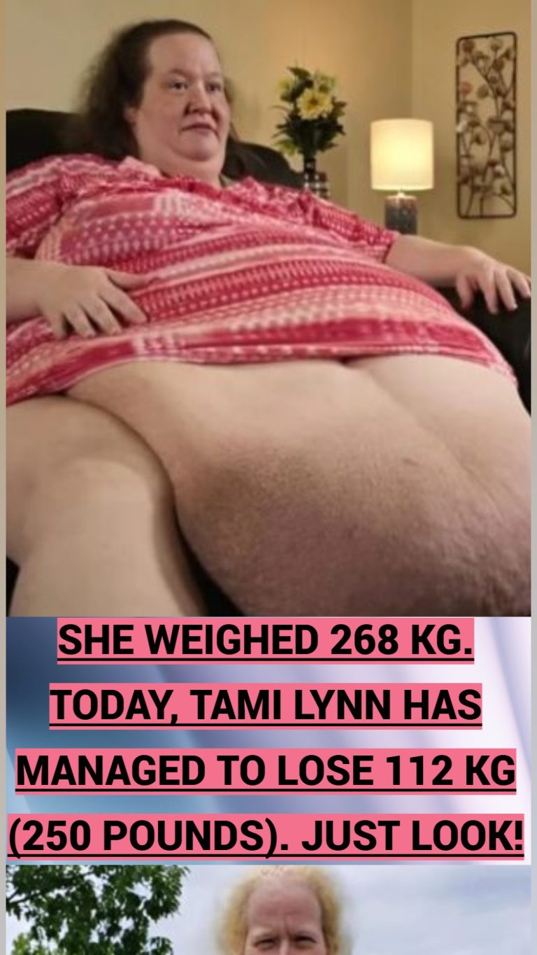 He weighed 268 kg. Today, he inspires thousands with his impressive weight loss.