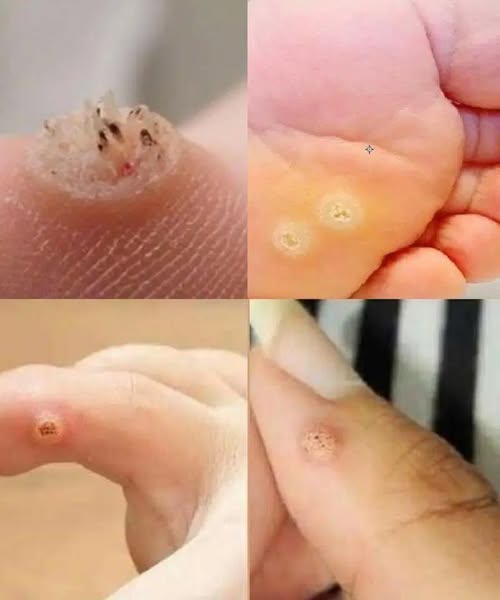 Be very careful if it comes out in your mouth, you are…