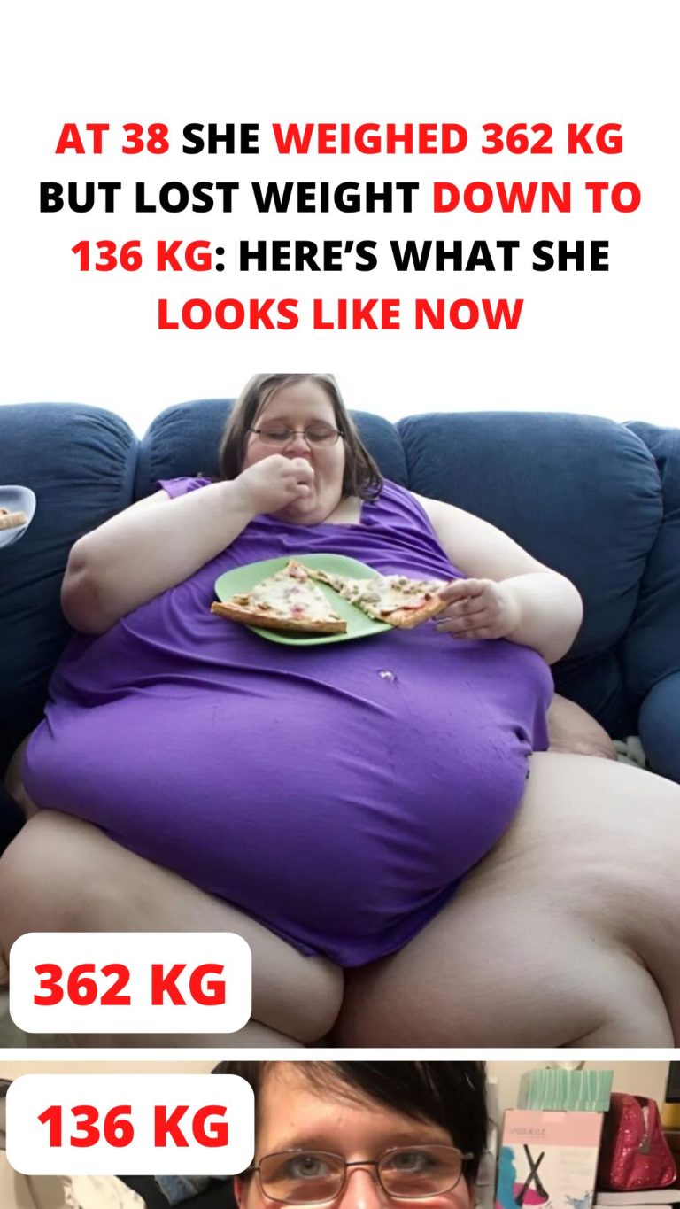 At 38 she weighed 362 kg but lost weight down to 136 kg: here’s what she looks like after all the changes