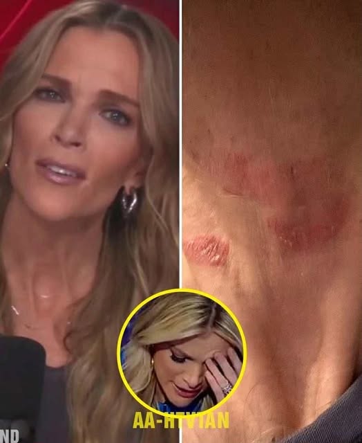 Megyn Kelly Hospitalized in Critical Condition