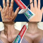 “It Looks Like I Had a Cosmetic Procedure”: The At-Home Remedy People Are Using to Improve the Appearance of Wrinkles and Dark Spots on Hands and Arms