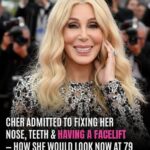 Cher Previously Discussed Having a Facelift – How She Looks Now at 79 and How AI Thinks She’d Look Naturally